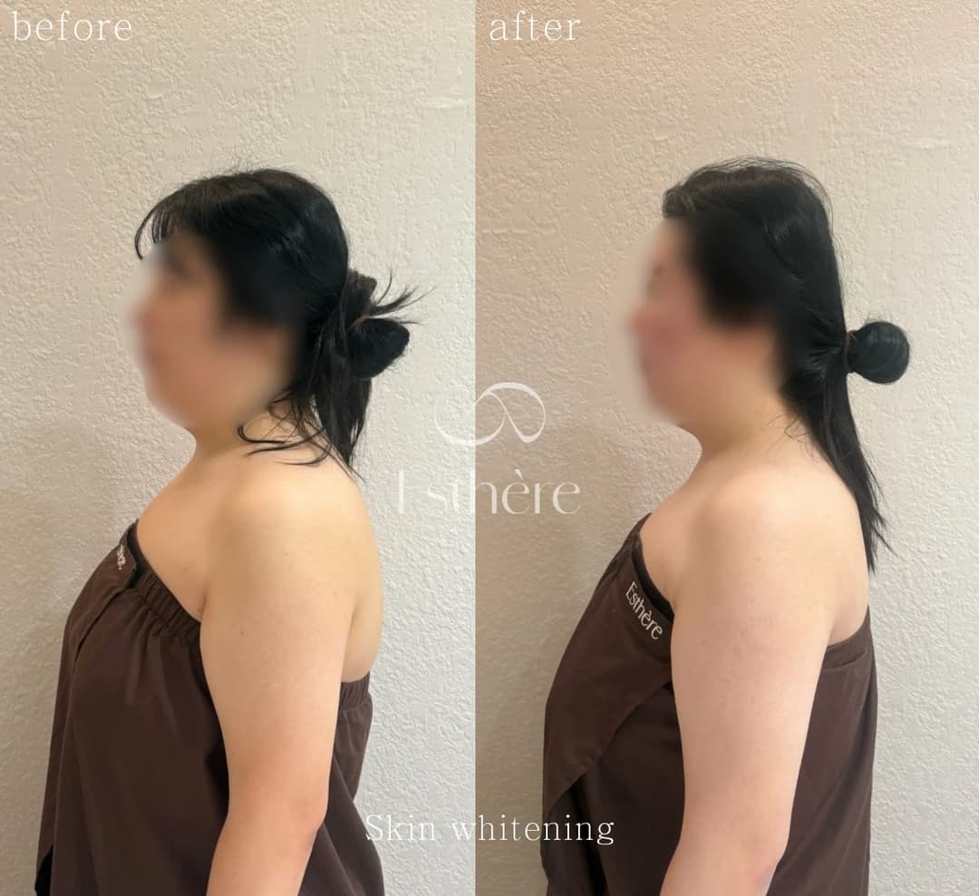 Full-body milk brightening — the shoulder from the side