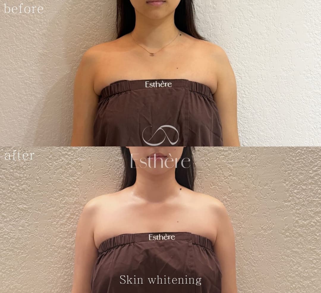 Full-body milk brightening — the décolletage and neck