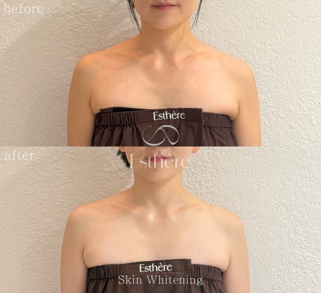 앞에서 본 가슴 위쪽 톤을 밝힌 전신 밀크미백