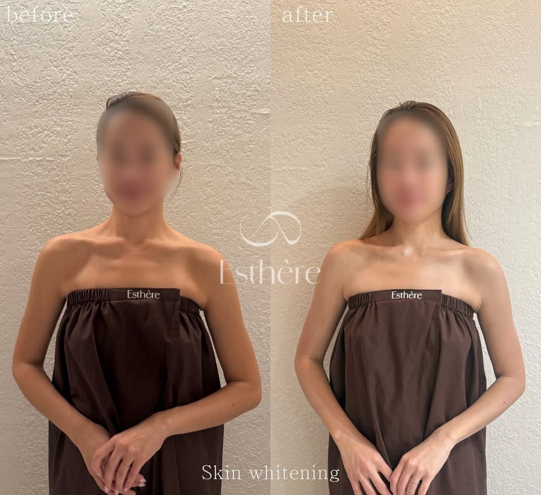 Full-body milk brightening — the upper body from the front