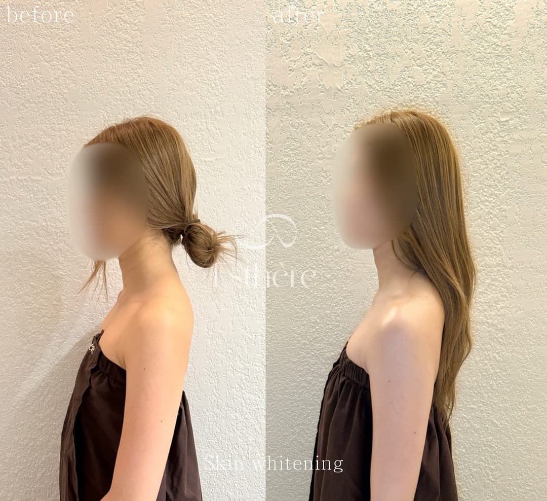 Full-body milk brightening — the neckline from the side