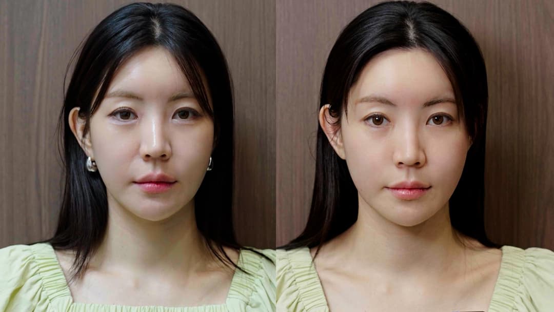 Alltight — Before and after